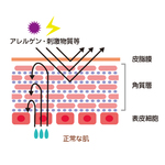 正常な肌　Normal skin
